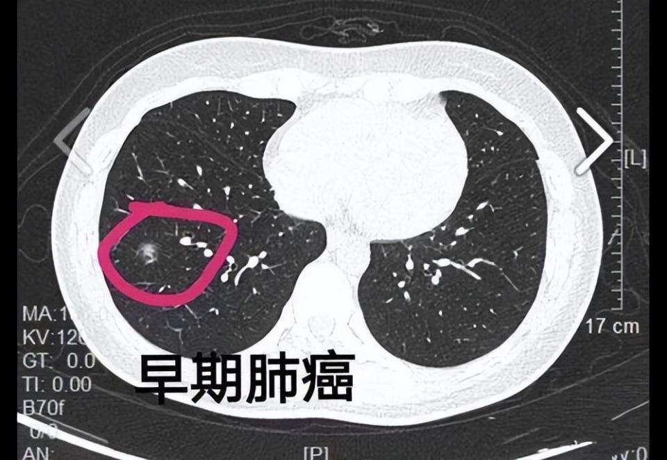 冠肺最新情况论述，掌握最新动态，科学应对挑战